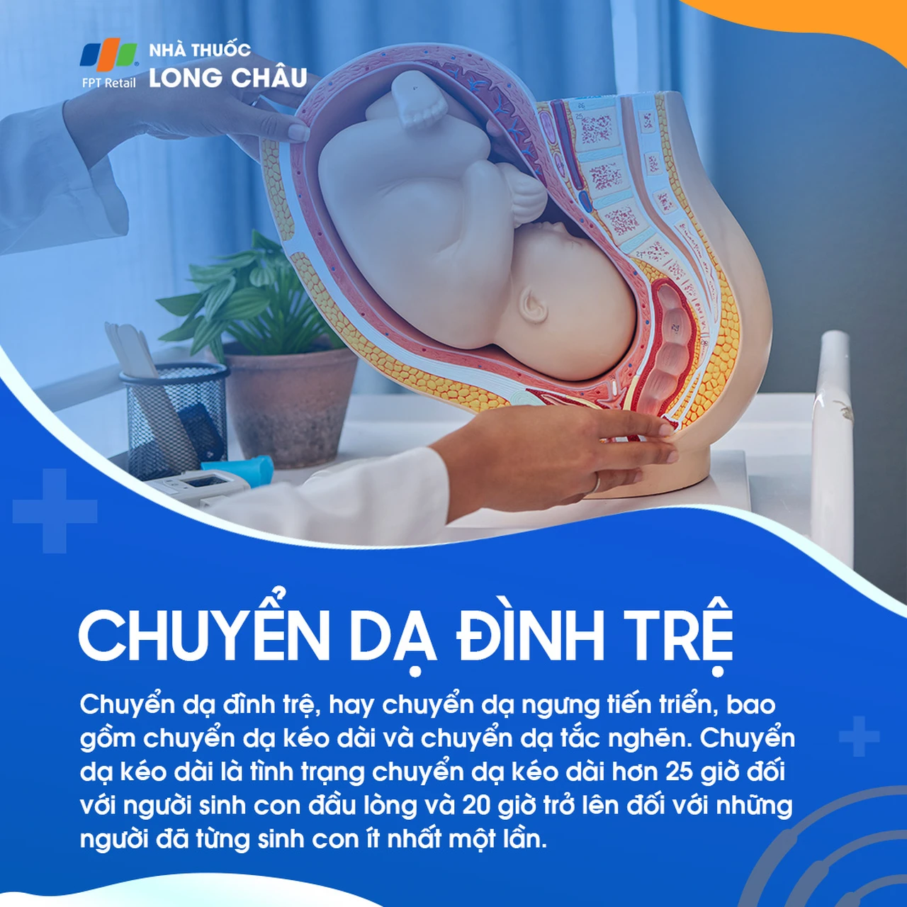 Chuyển dạ đình trệ 1