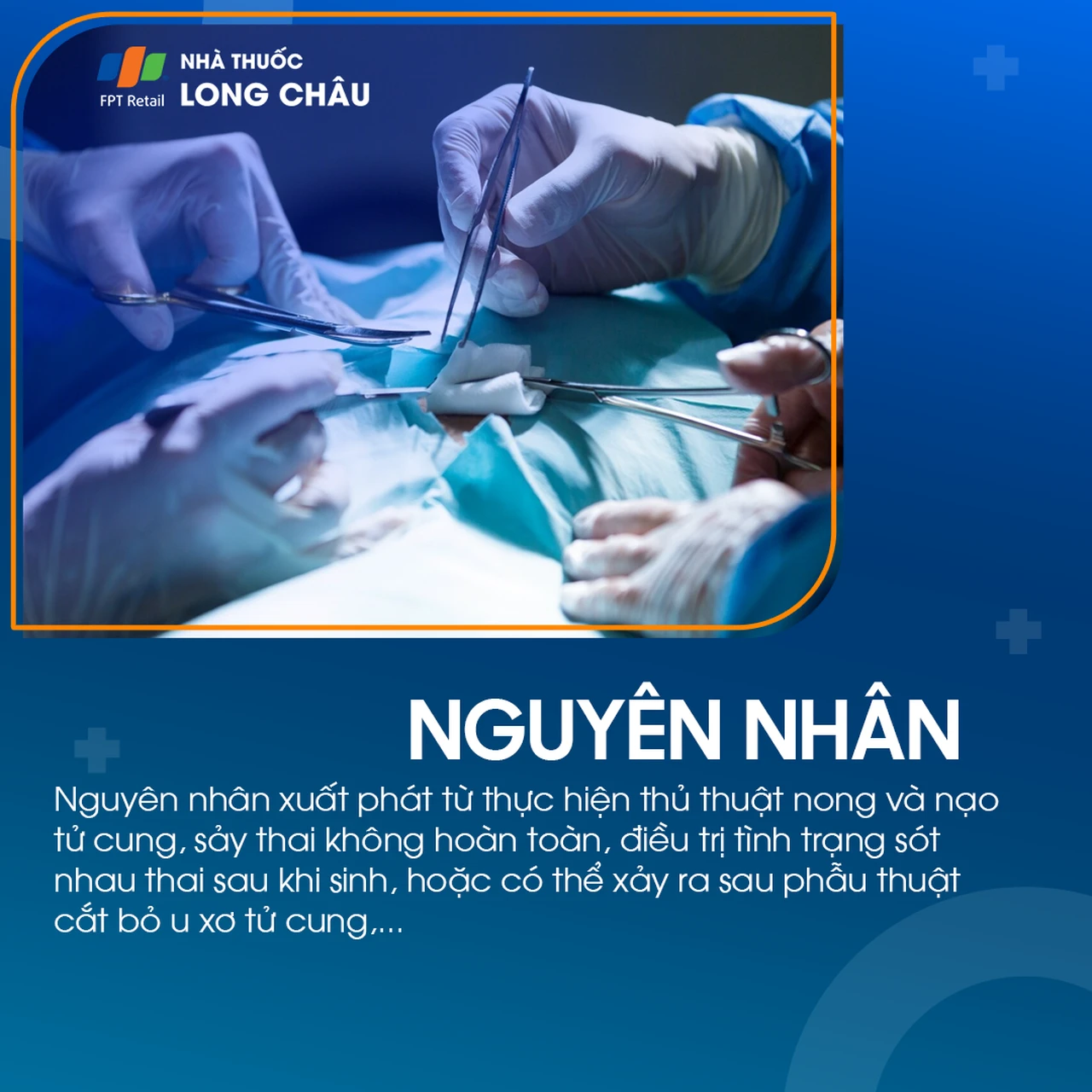 Dính buồng tử cung 3