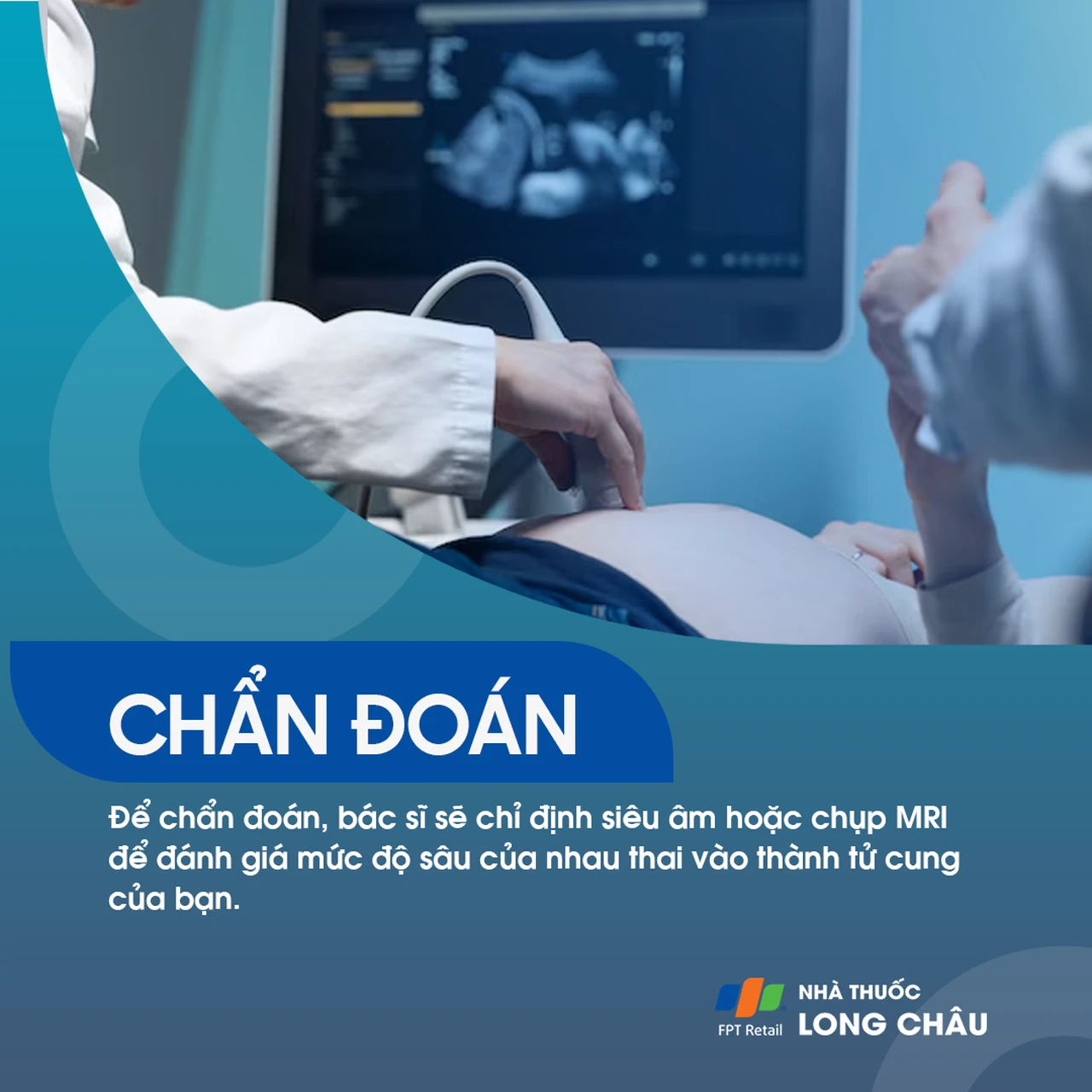 Nhau cài răng lược 5