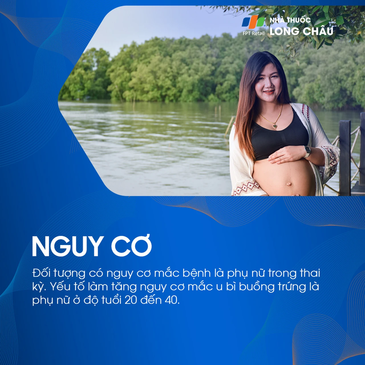 U bì buồng trứng 4