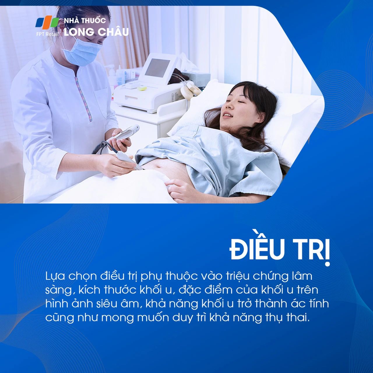 U bì buồng trứng 6