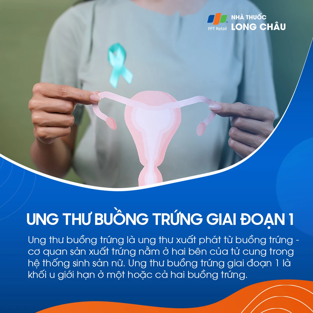 Ung thư buồng trứng giai đoạn 1 - 1
