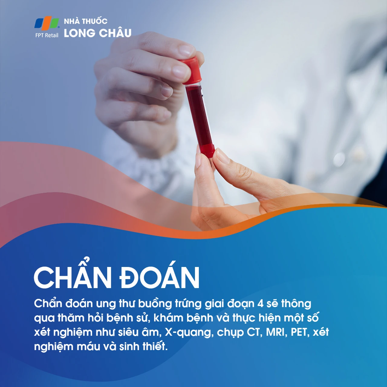 Ung thư buồng trứng giai đoạn 4 - 5