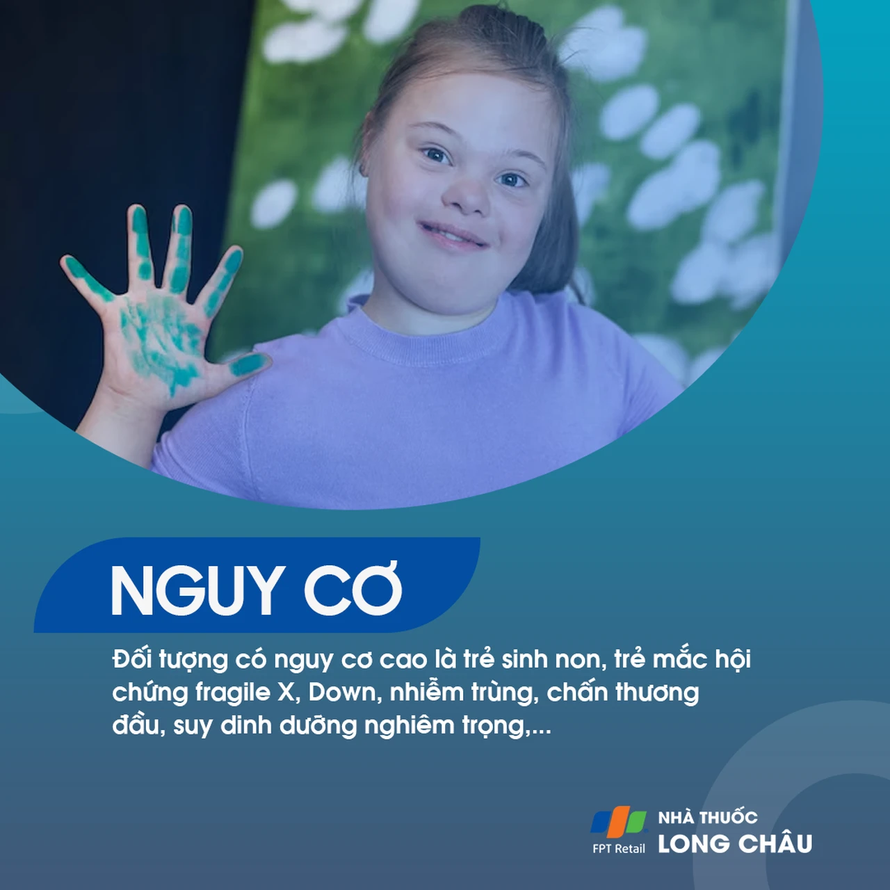 Chậm phát triển tâm thần 5