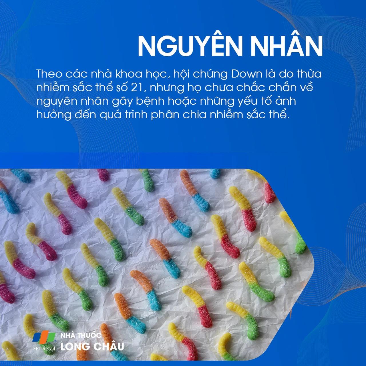 Hội chứng Down 3