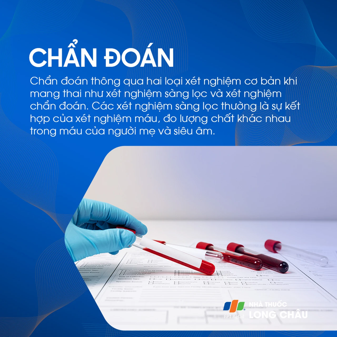 Hội chứng Down 5