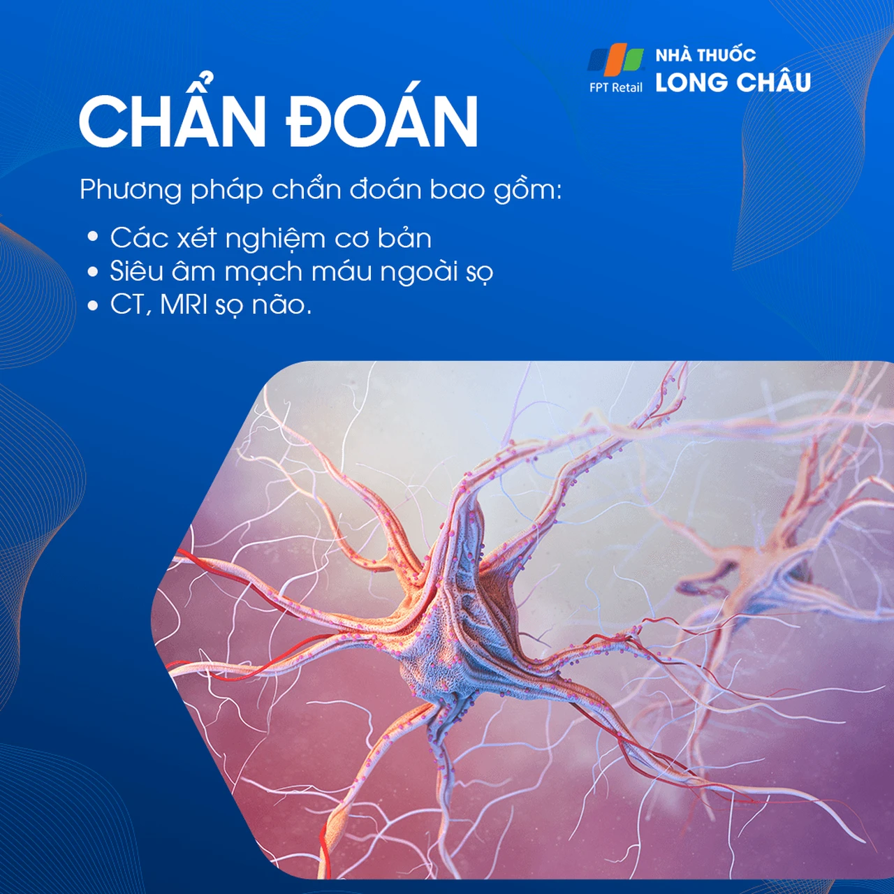 Chẩn đoán rối loạn tiền đình thông qua xét nghiệm thăng bằng và kiểm tra tai trong