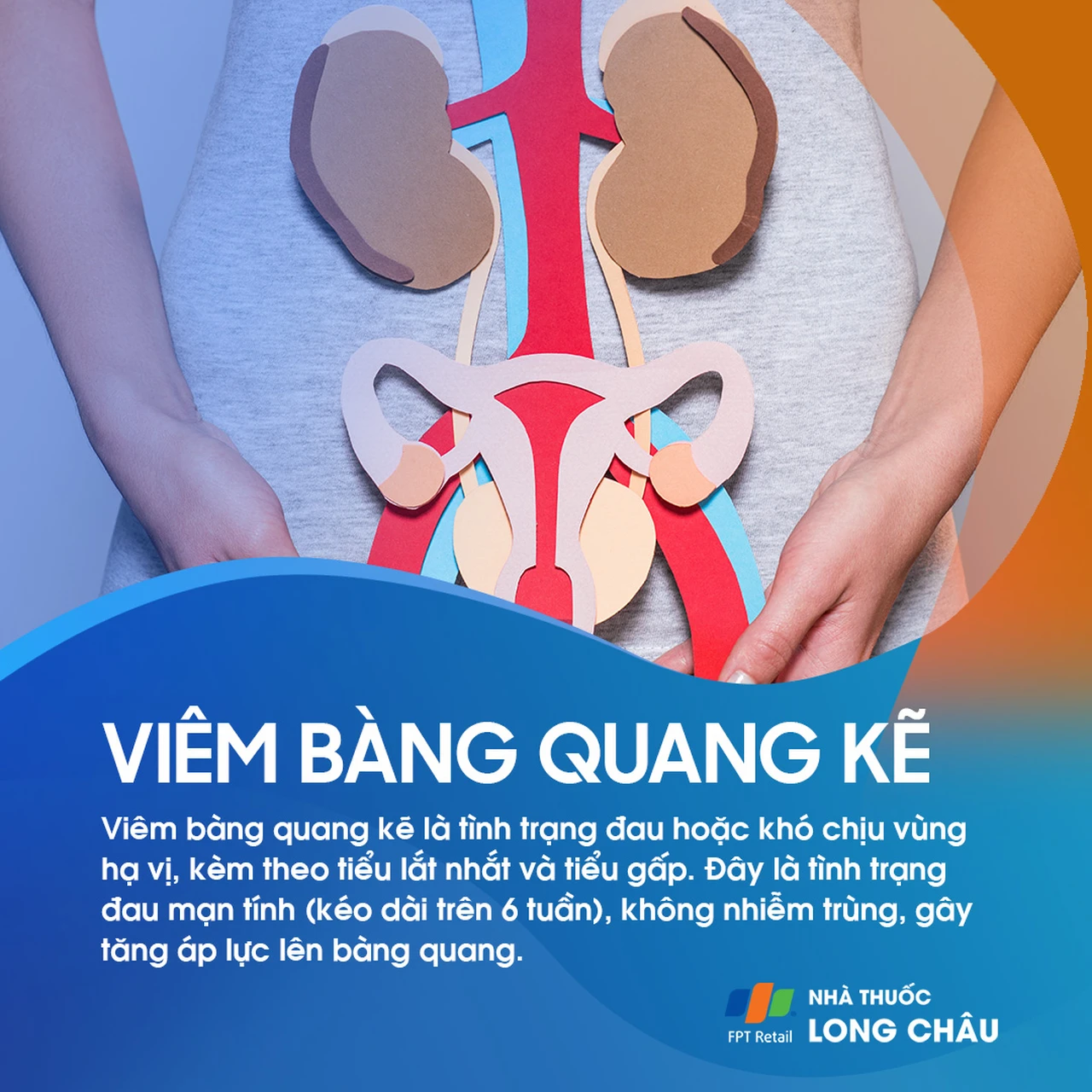 Viêm bàng quang kẽ 1