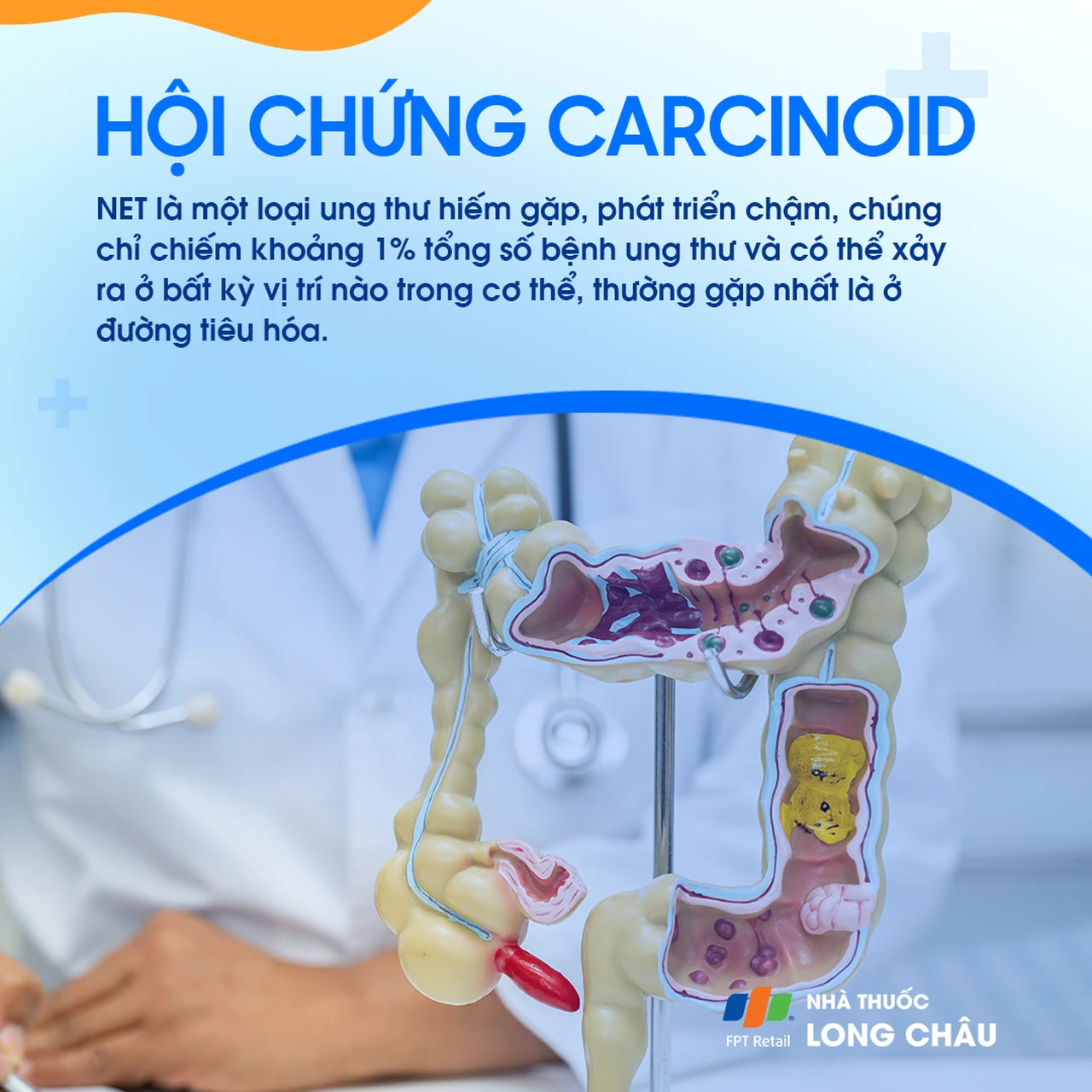 Hội chứng carcinoid 2