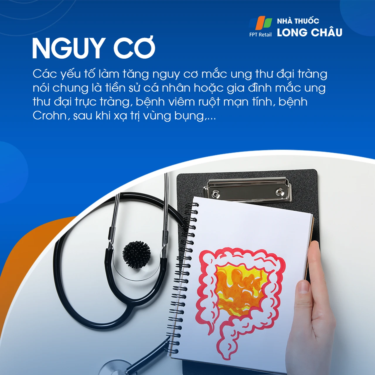 Ung thư đại tràng giai đoạn 1 5