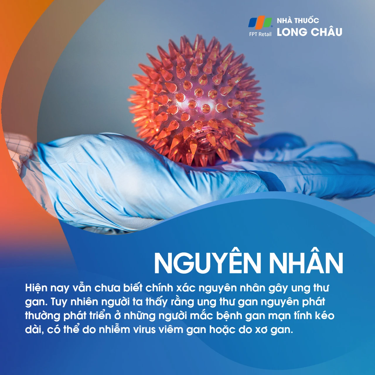 Ung thư gan nguyên phát 3