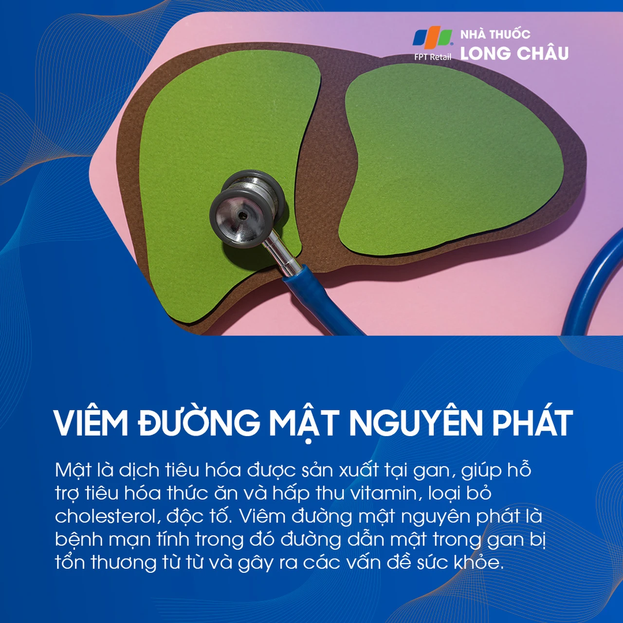 Viêm đường mật nguyên phát 1