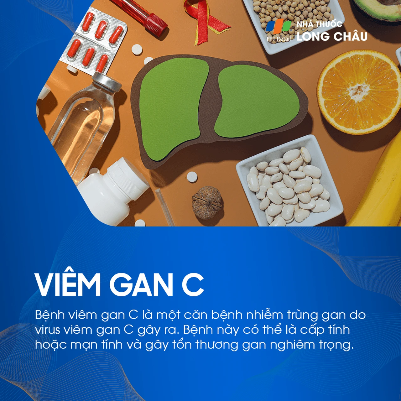 Viêm gan C - Tìm hiểu về bệnh lý viêm gan C 