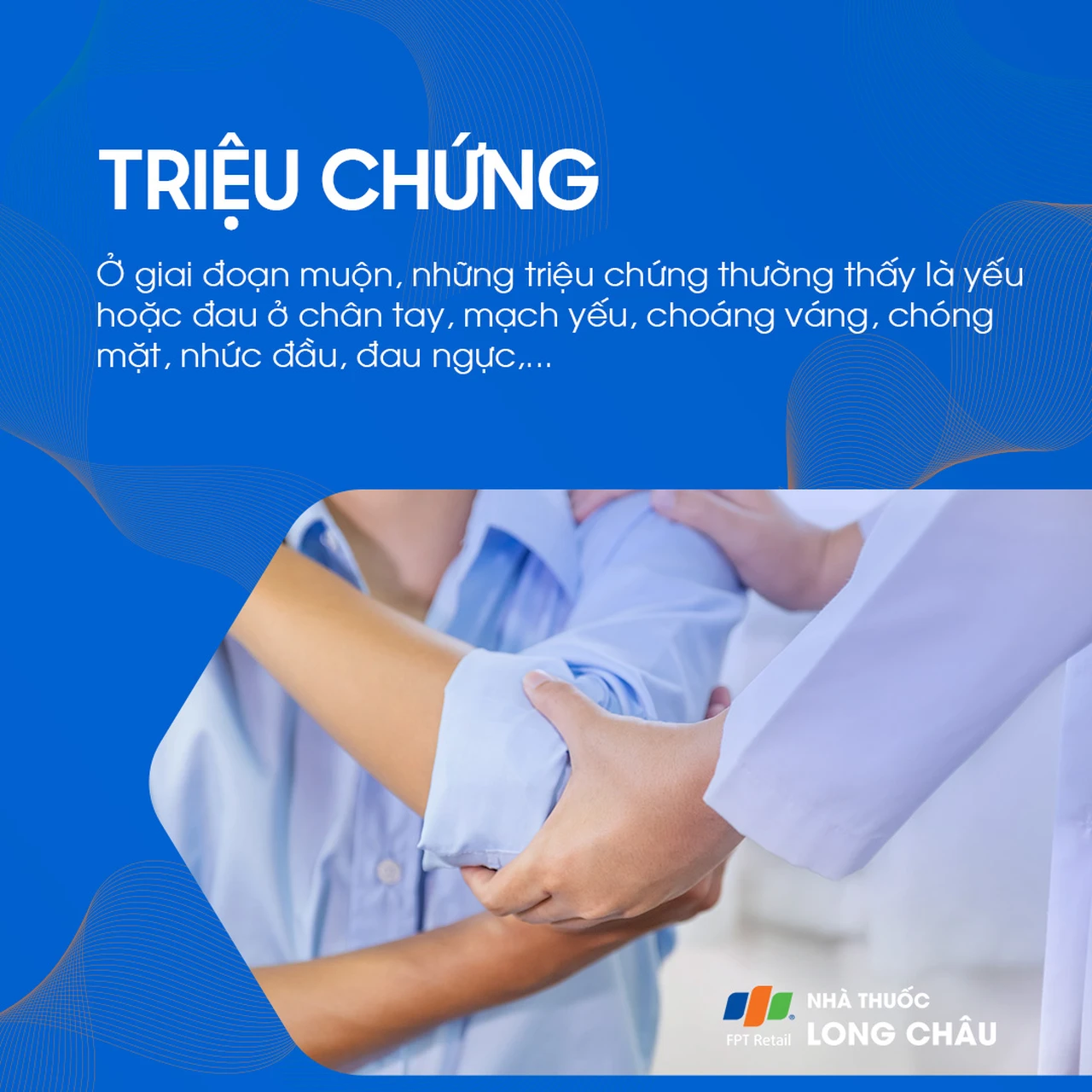 Viêm động mạch Takayasu 3