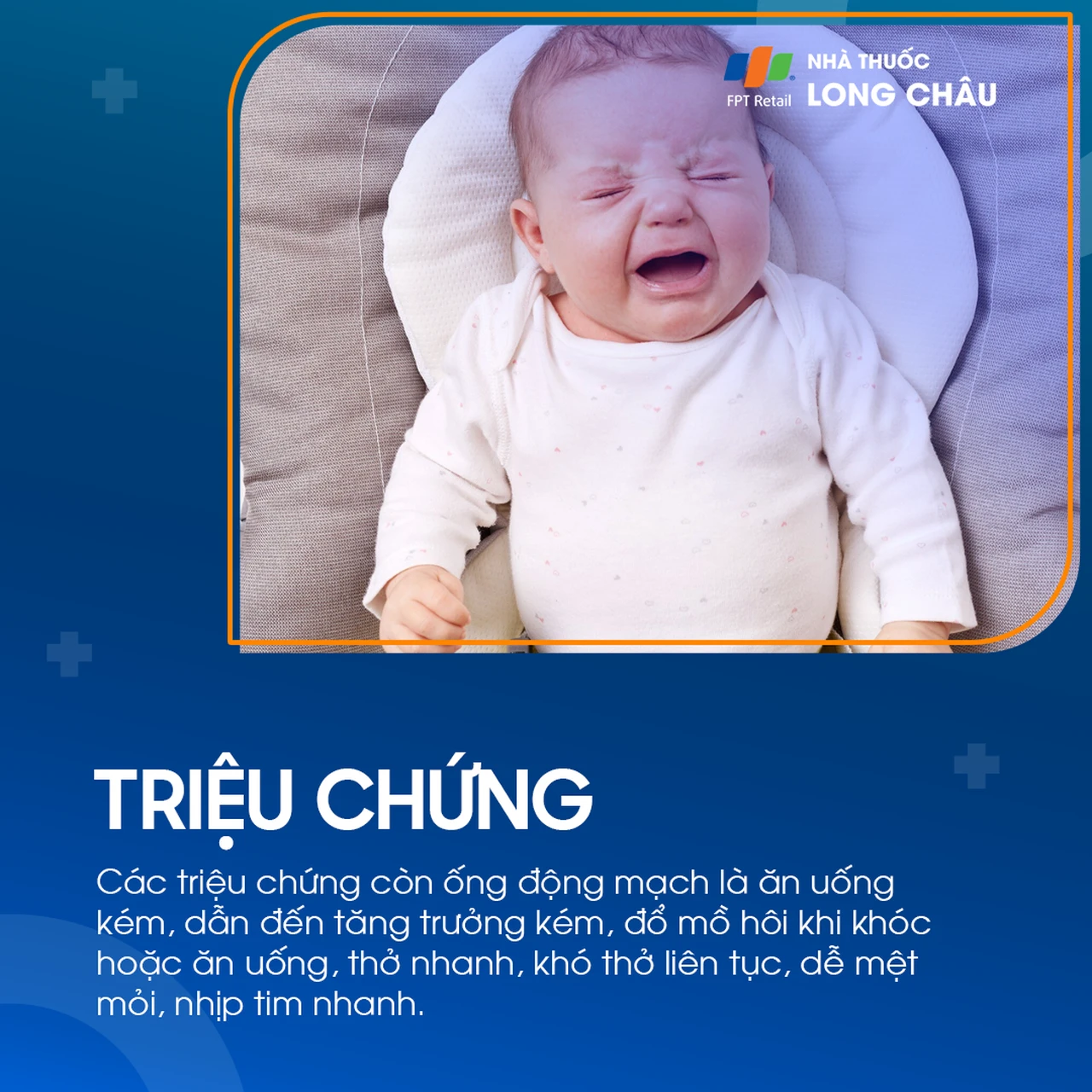 Còn ống động mạch 3