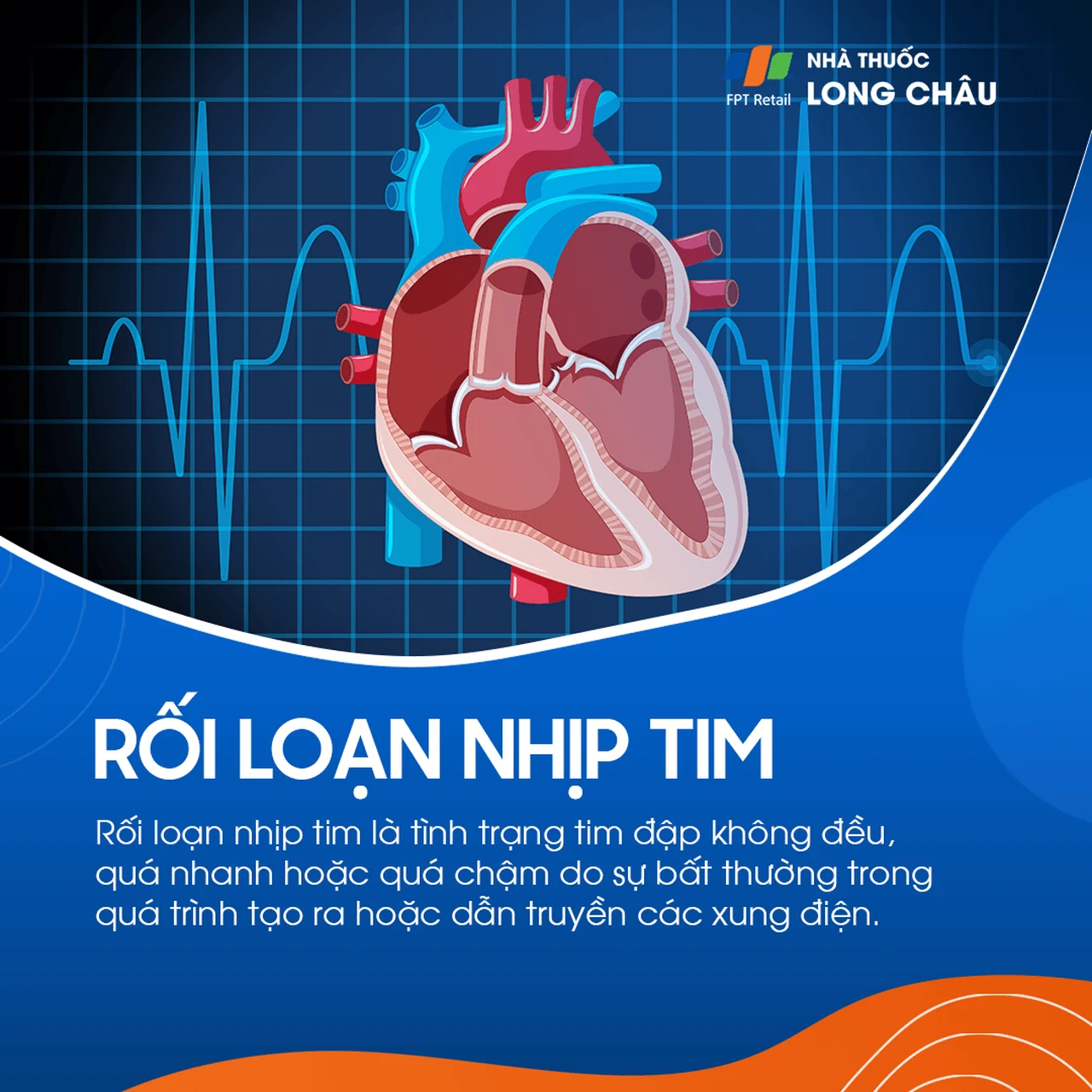 Rối loạn nhịp tim 1