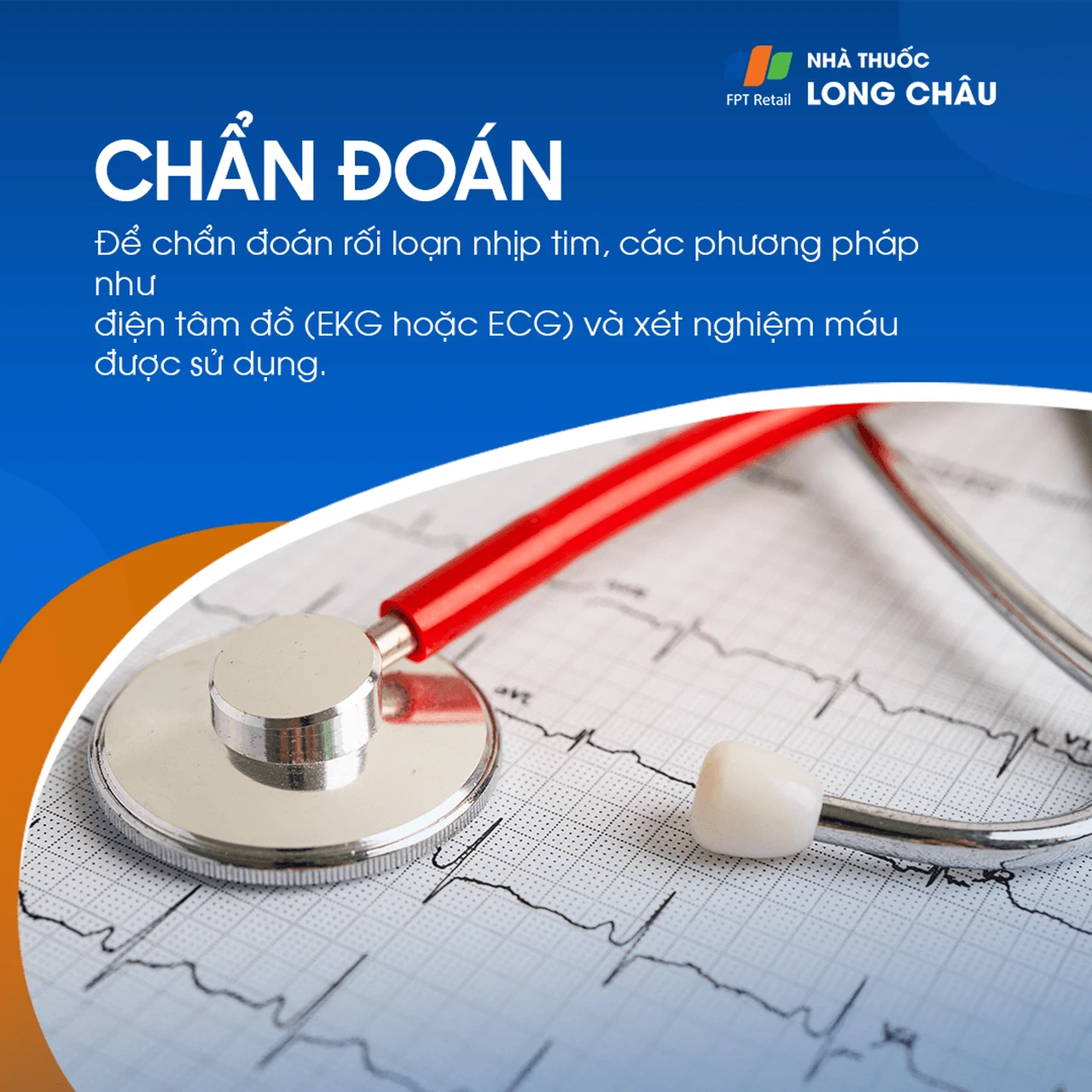 Chẩn đoán rối loạn nhịp tim qua điện tâm đồ (ECG) và xét nghiệm máu