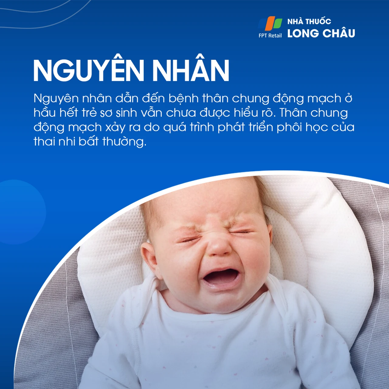 Thân chung động mạch 3