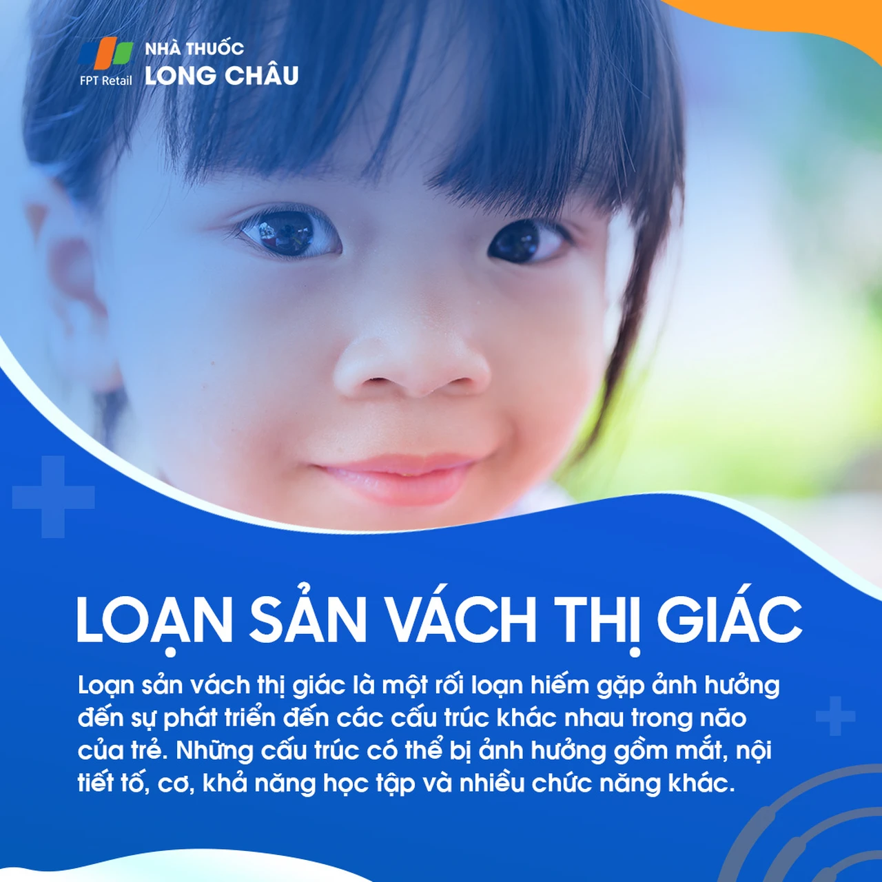 Loạn sản vách thị giác 1