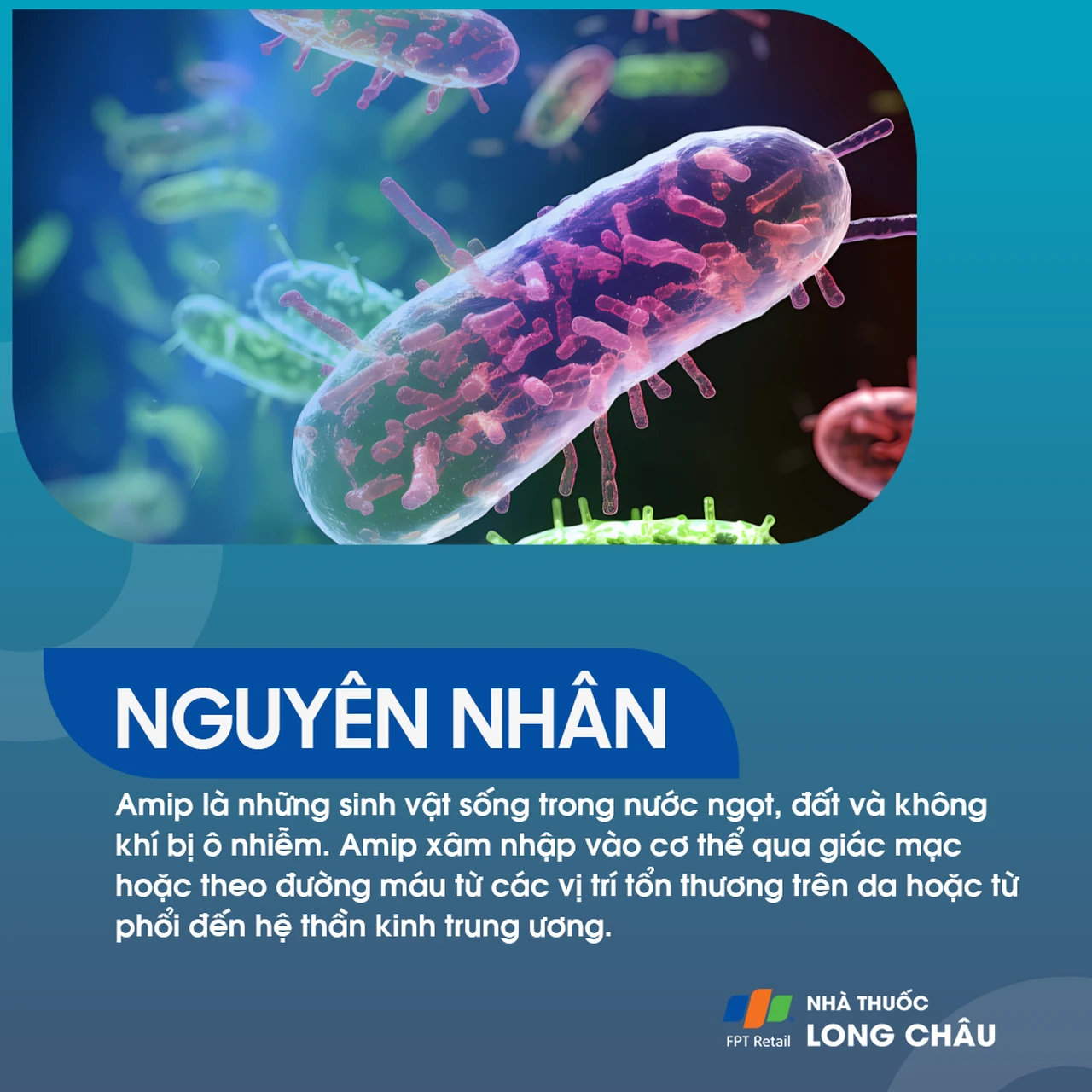 Viêm não dạng u hạt do Amip 3