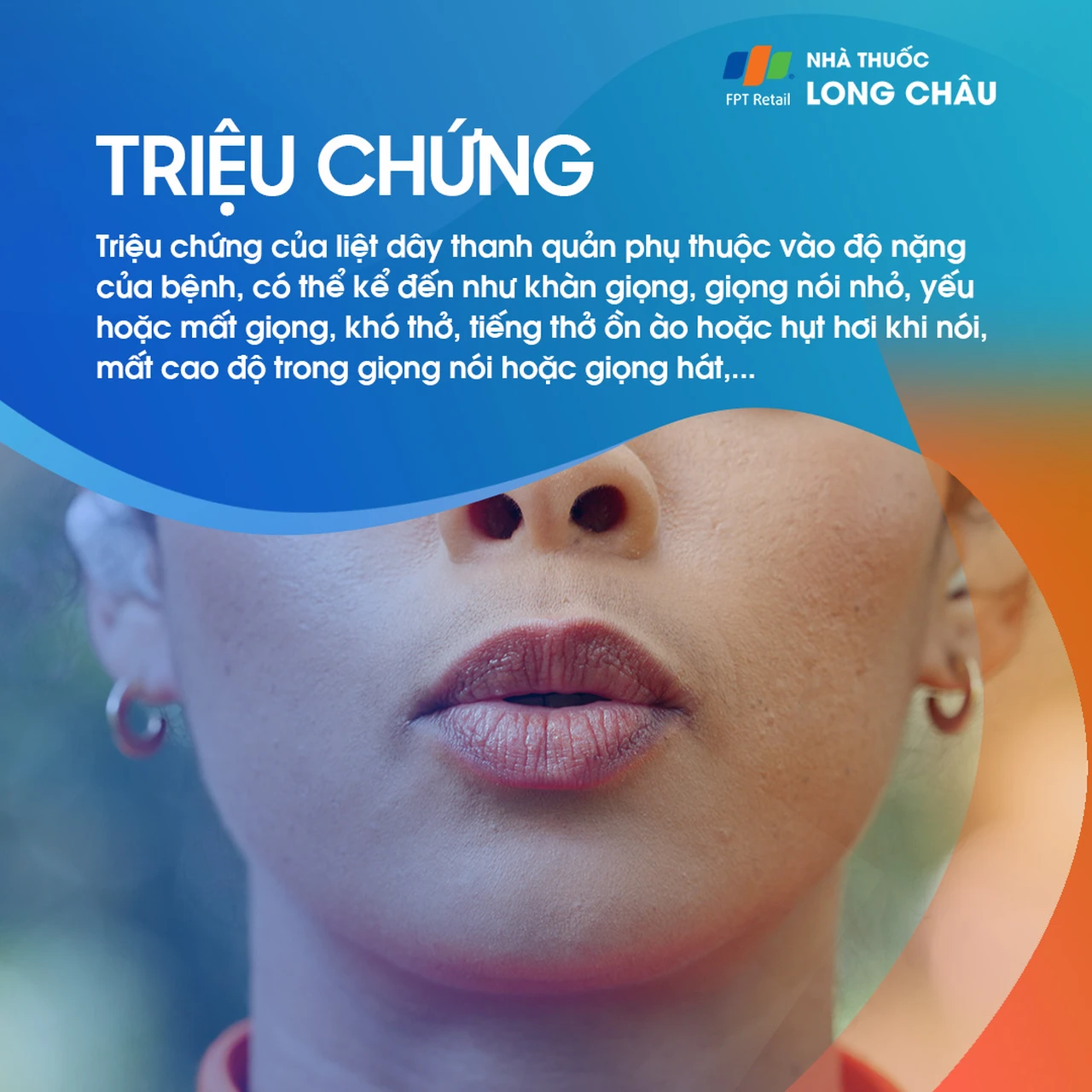 Liệt dây thanh quản 2