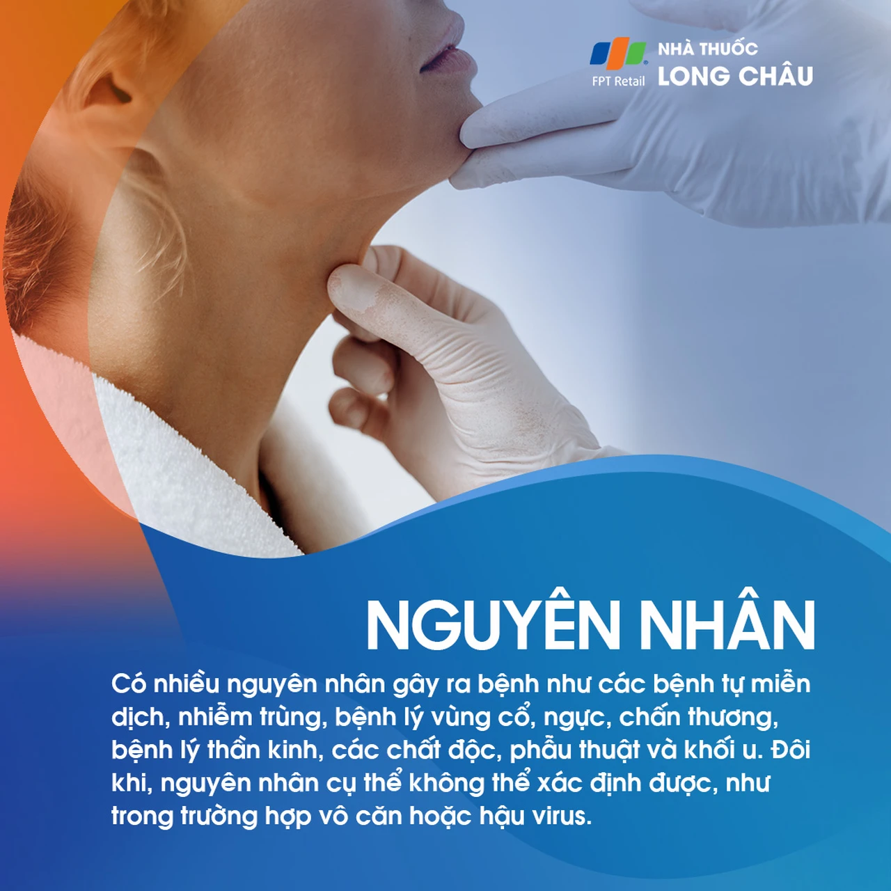 Liệt dây thanh quản 3