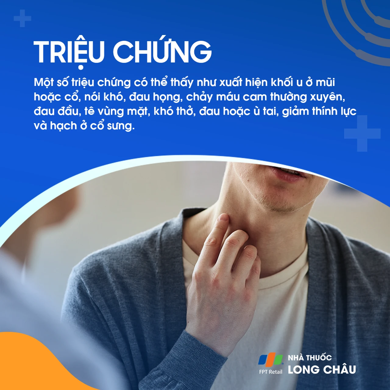 Ung thư vòm họng giai đoạn 1 - 3