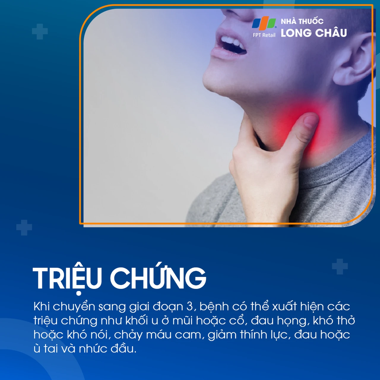 Ung thư vòm họng giai đoạn 3 - 2