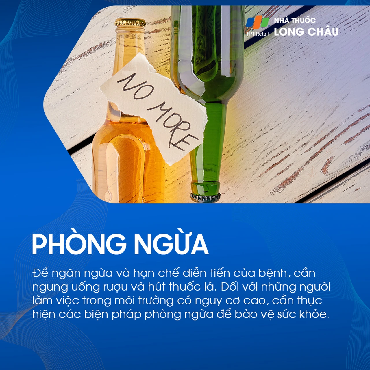 U tuyến nước bọt mang tai 10