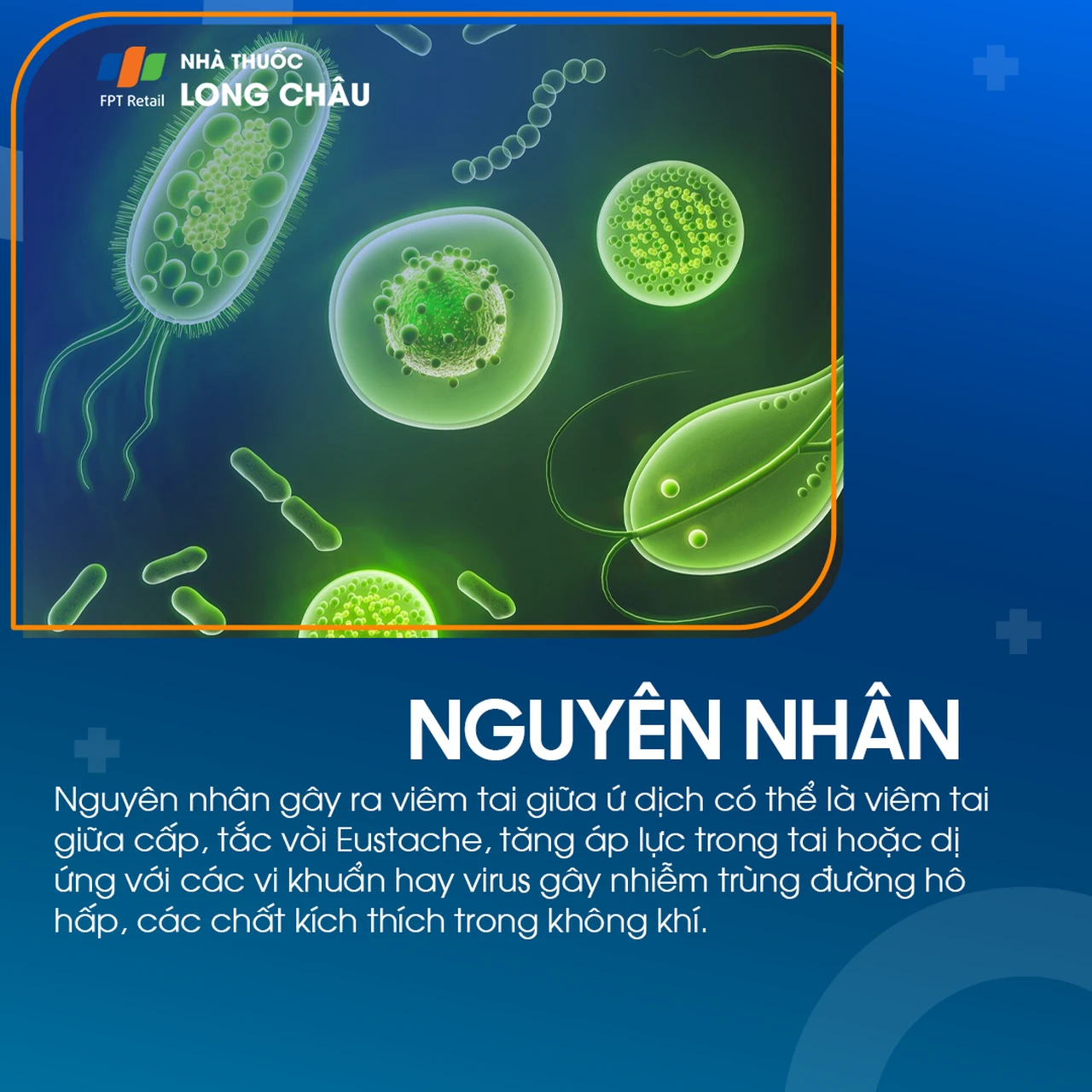 Viêm tai giữa ứ dịch 3