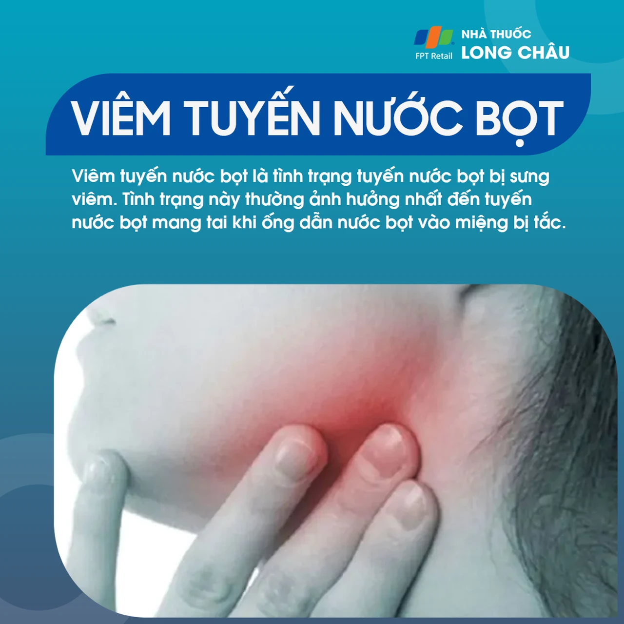 Viêm tuyến nước bọt 1
