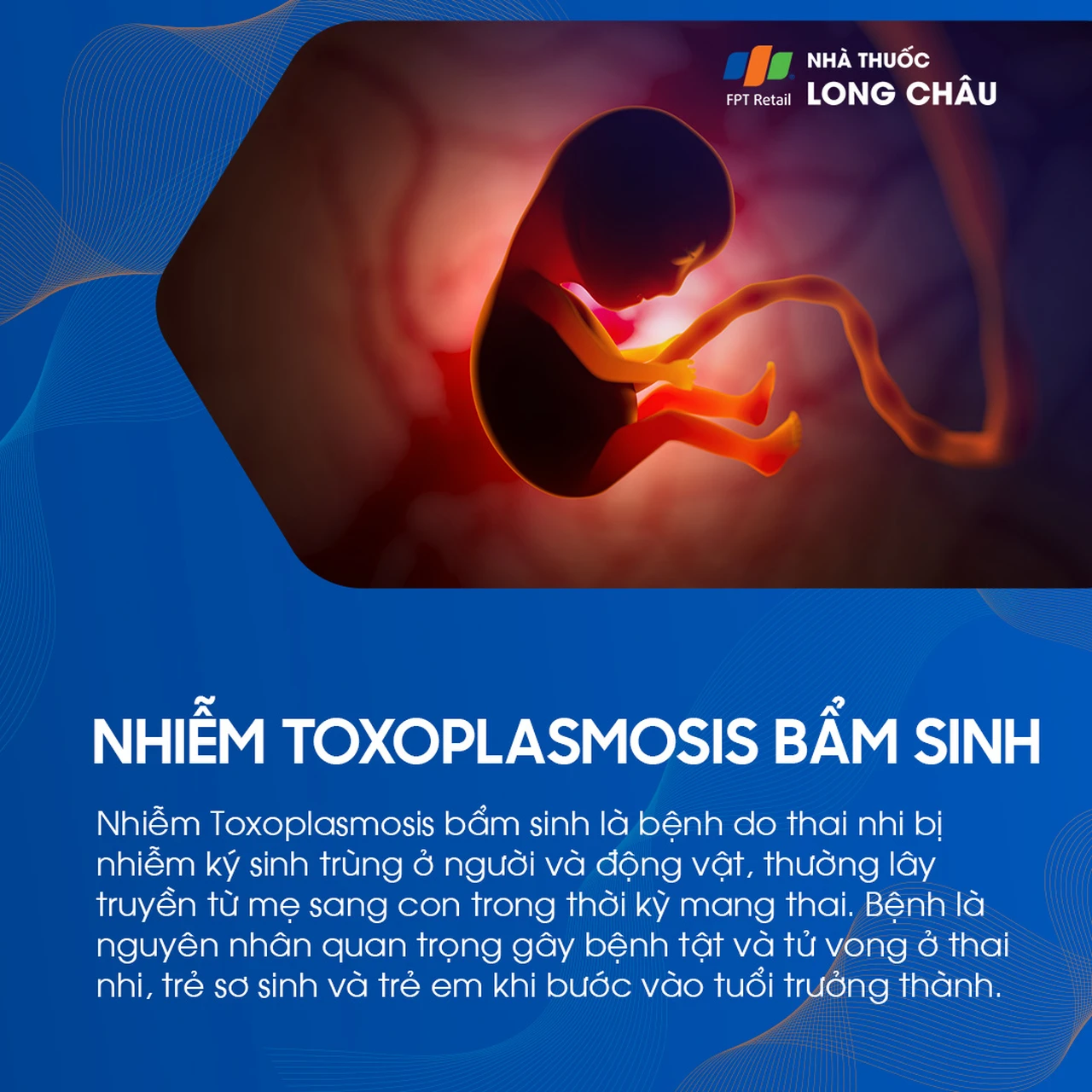 Nhiễm Toxoplasmosis bẩm sinh 1