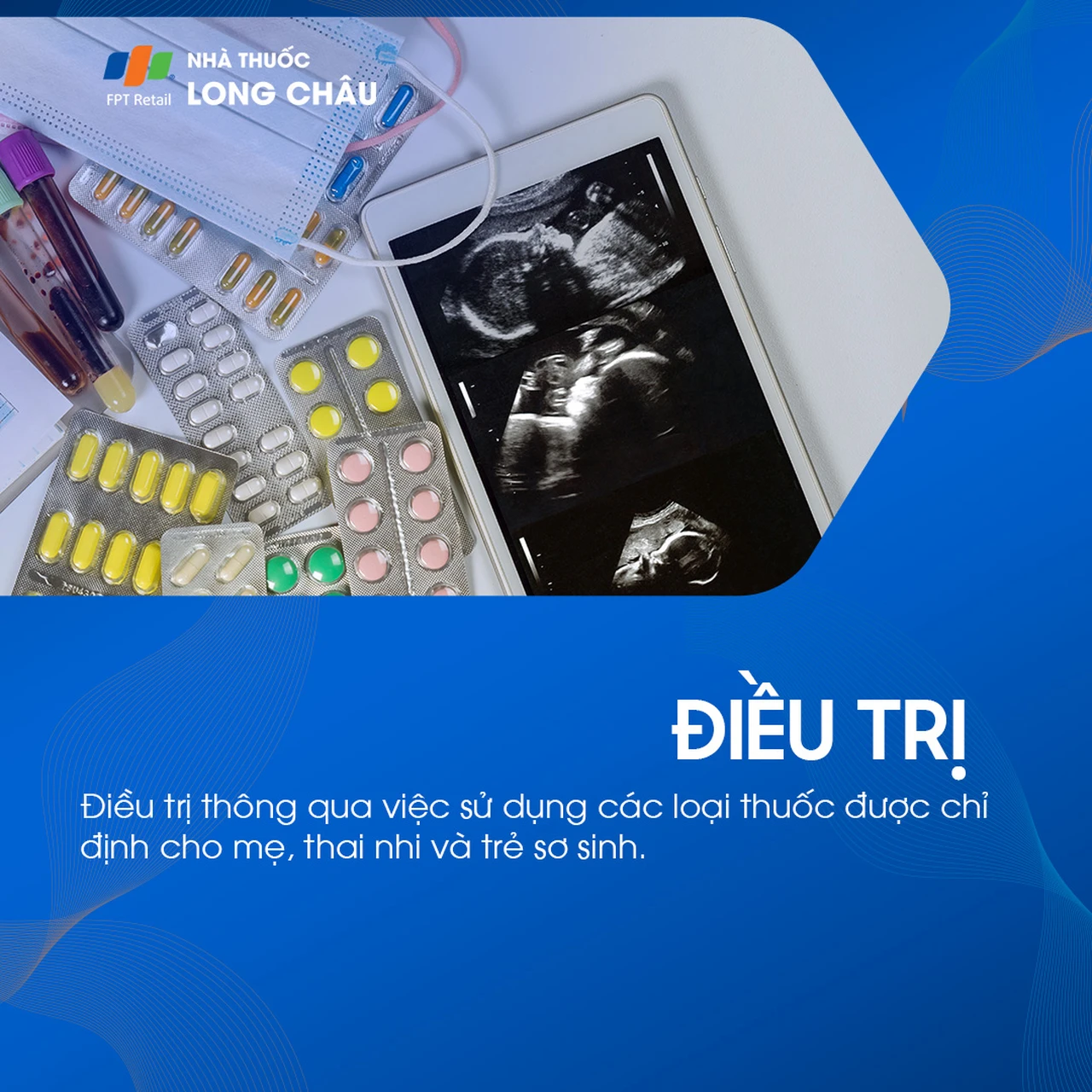 Nhiễm Toxoplasmosis bẩm sinh 7