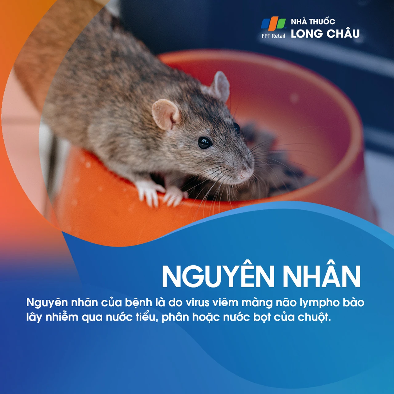 Viêm màng não lympho bào 4