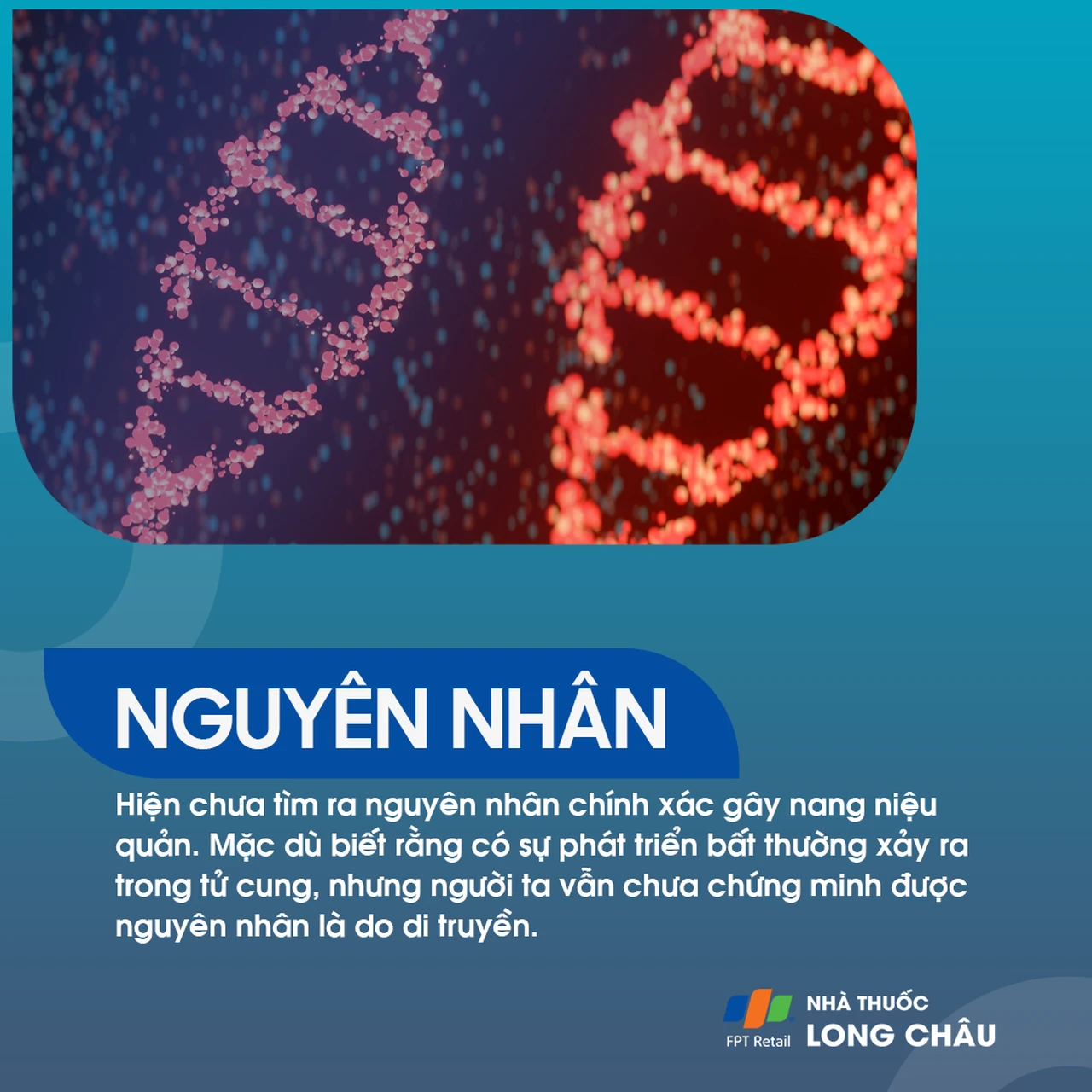 Nang niệu quản 3