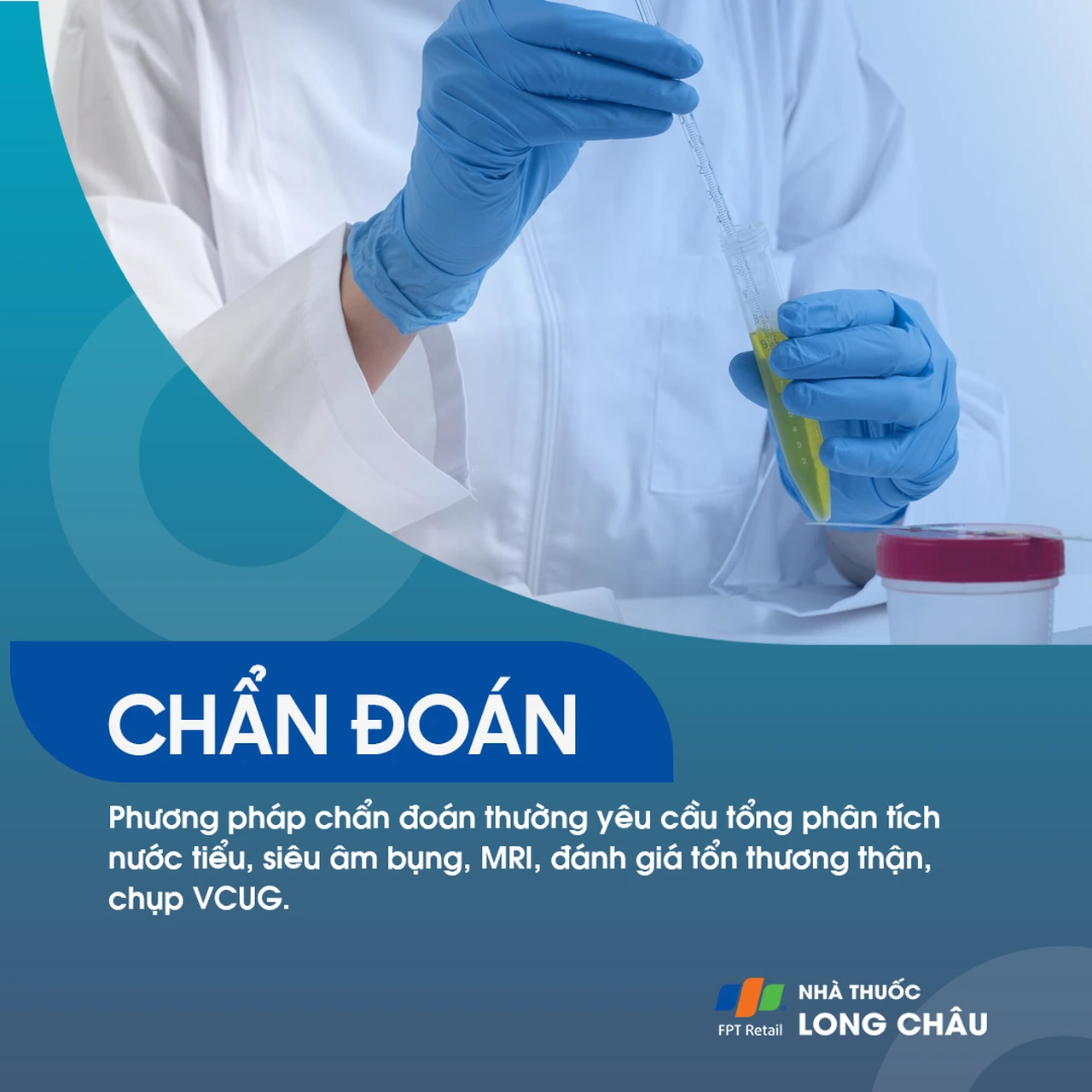 Nang niệu quản 5