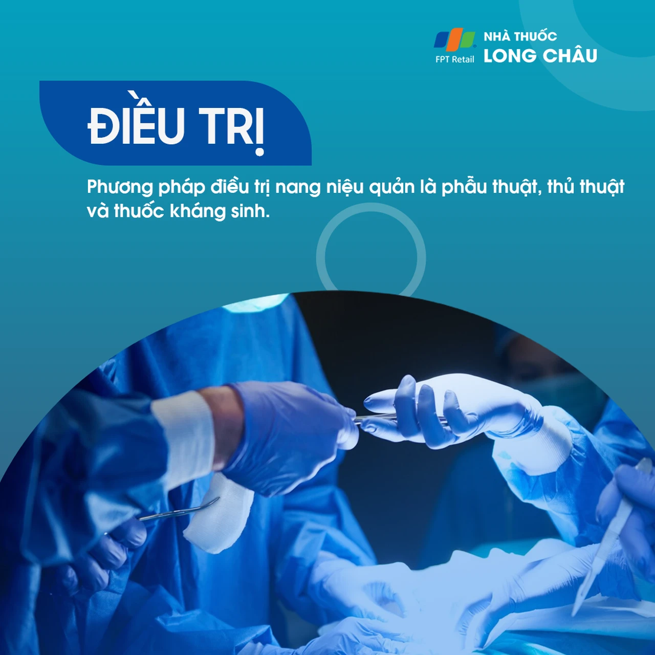 Nang niệu quản 6