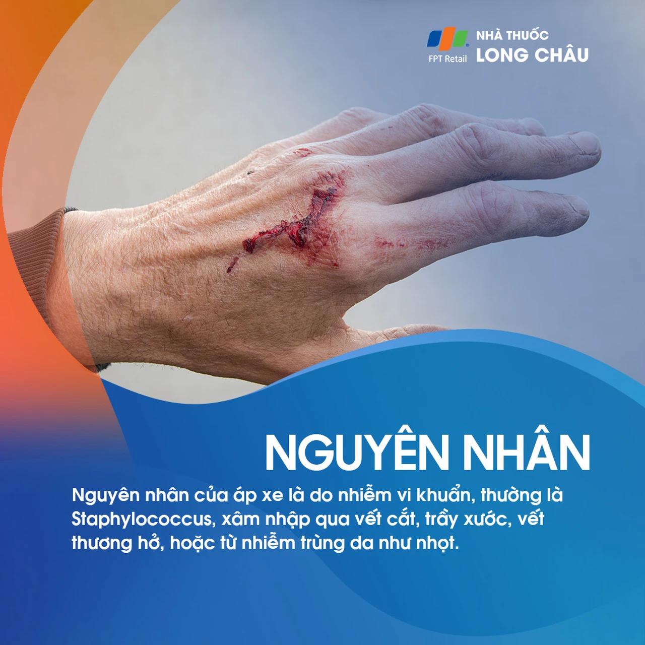 Áp xe lòng bàn tay 3