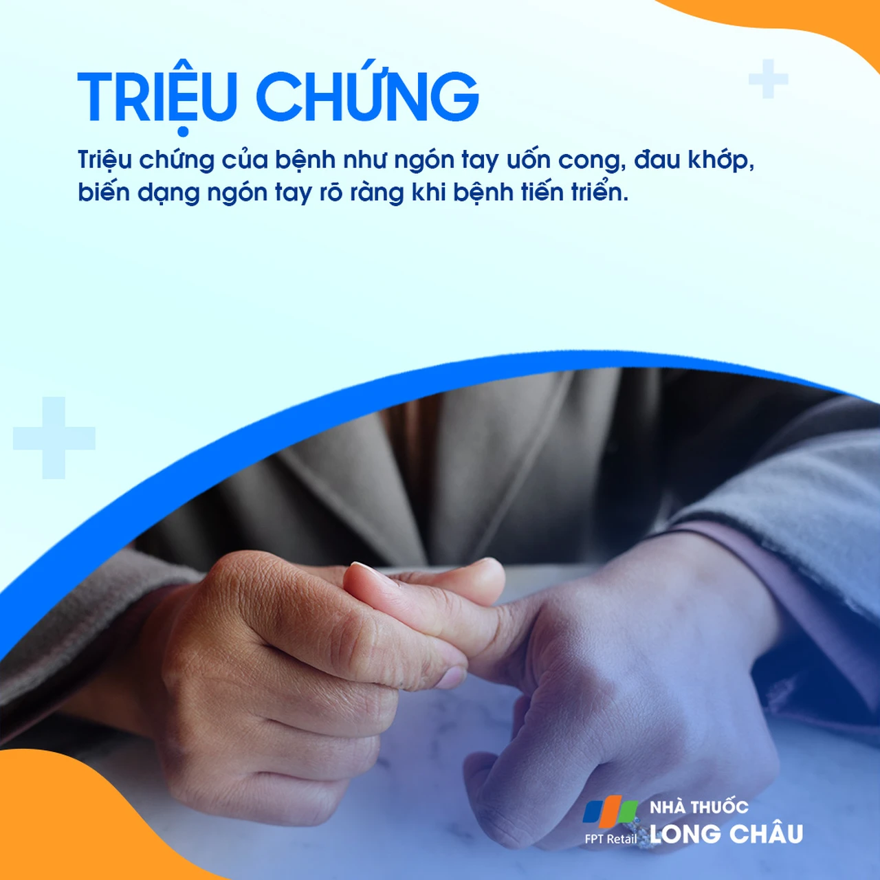 Ngón tay duỗi quá mức ở khớp gần và gập ở khớp xa, gây đau và biến dạng