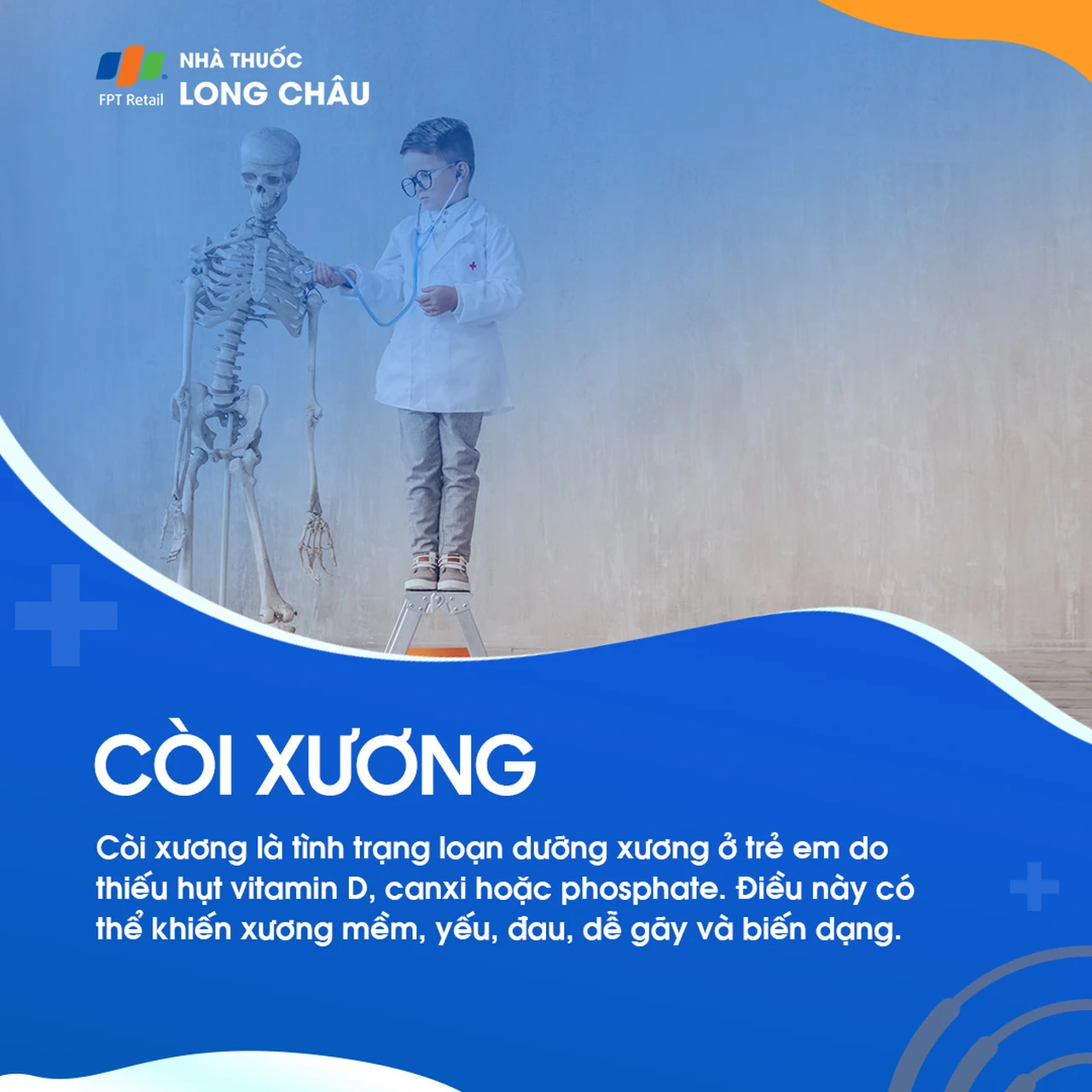 Còi xương là tình trạng loạn dưỡng xương ở trẻ do thiếu vitamin D, canxi hoặc phosphate