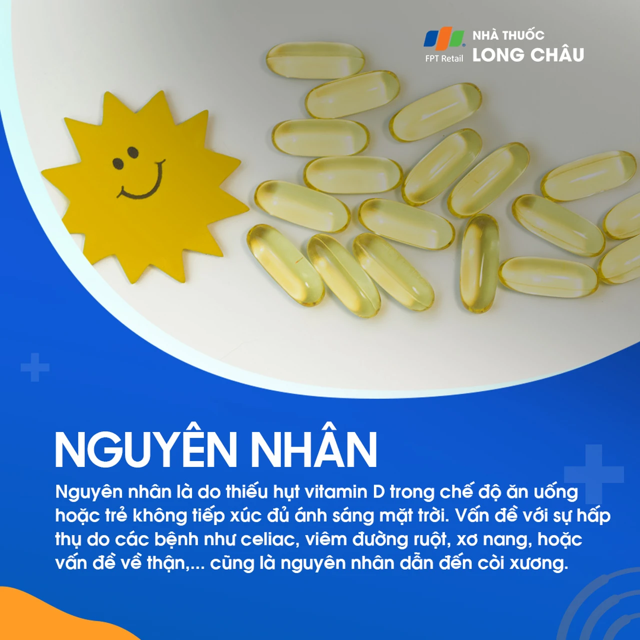 Còi xương do thiếu vitamin D, ít tiếp xúc nắng, hoặc kém hấp thu do bệnh tiêu hóa/thận