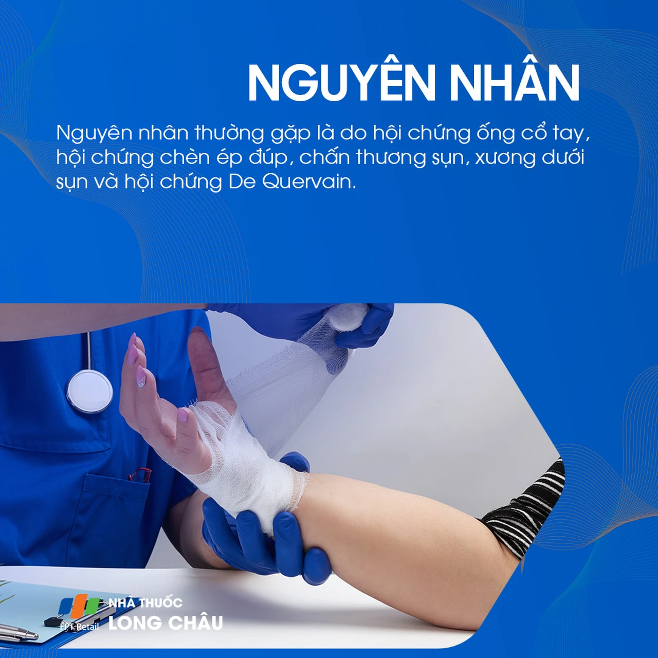 Nguyên nhân đau cổ tay thường là hội chứng ống cổ tay, chèn ép dây thần kinh, tổn thương sụn hoặc hội chứng De Quervain