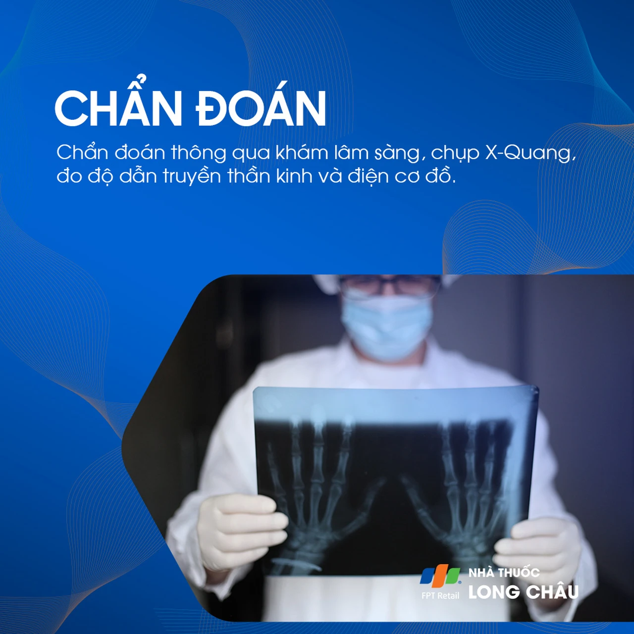 Đau cổ tay cần được chẩn đoán chính xác qua khám lâm sàng, chụp X-quang, đo dẫn truyền thần kinh hoặc điện cơ đồ