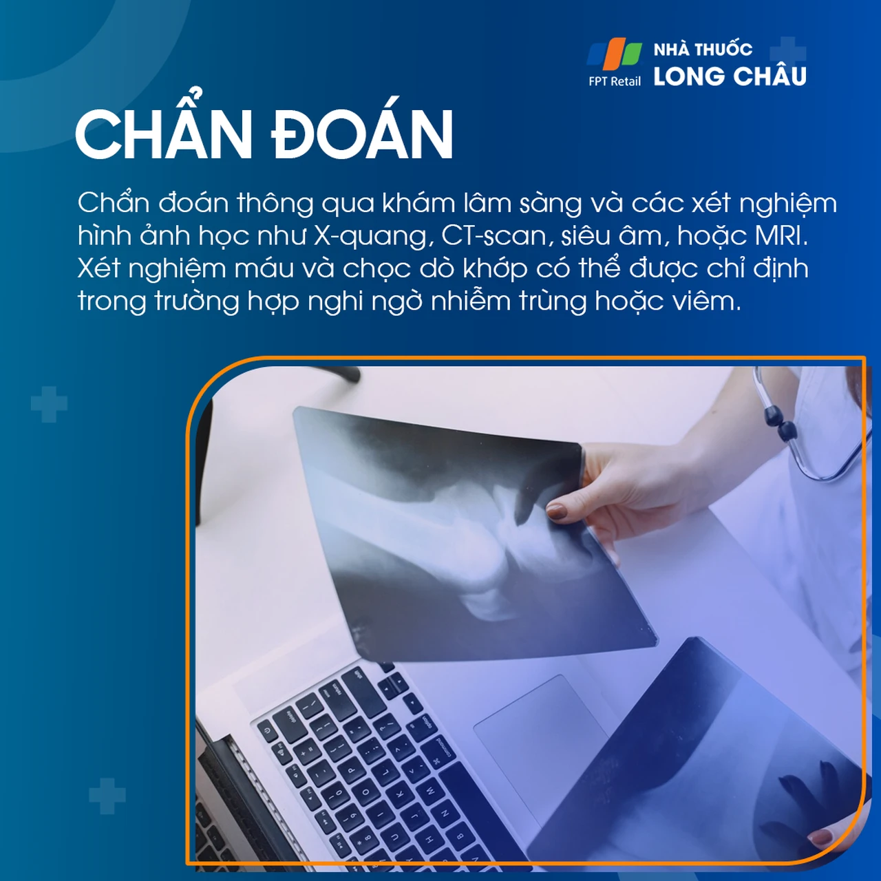 Đau đầu gối được chẩn đoán bằng khám lâm sàng, hình ảnh học như X-quang, MRI và các xét nghiệm máu, dịch khớp nếu nghi ngờ viêm/nhiễm trùng