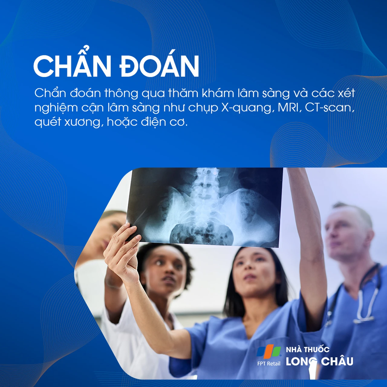 Để chẩn đoán nguyên nhân đau lưng, bác sĩ có thể chỉ định các xét nghiệm hình ảnh như X-quang, MRI, CT-scan sau khi thăm khám lâm sàng