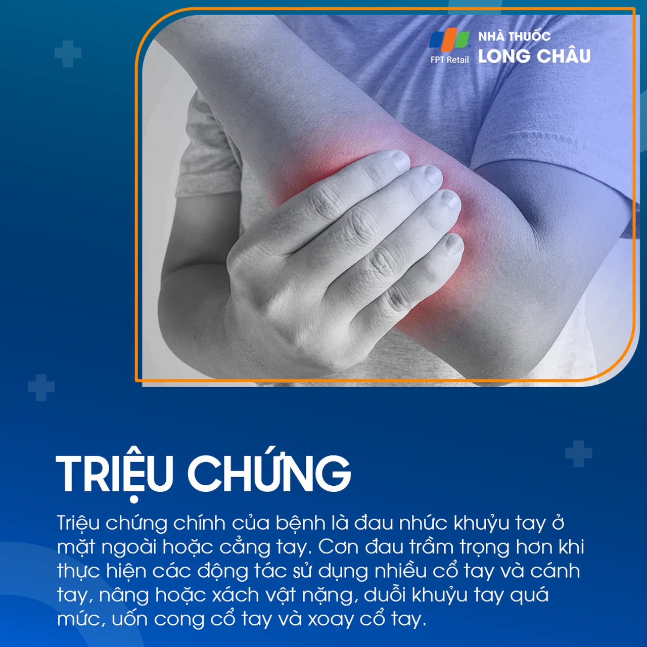 Hội chứng đường hầm xương quay 2