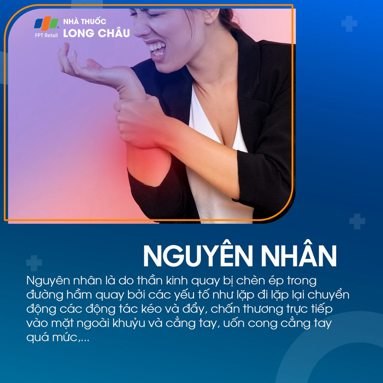 Hội chứng đường hầm xương quay 3