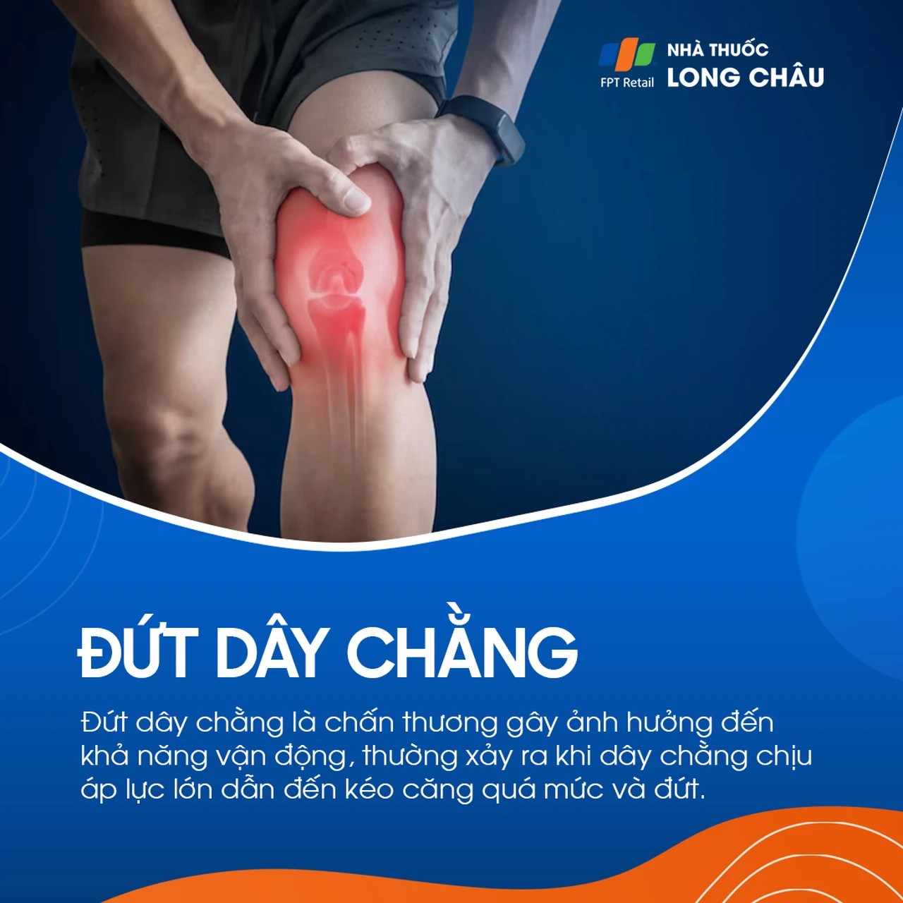 Đứt dây chằng 1