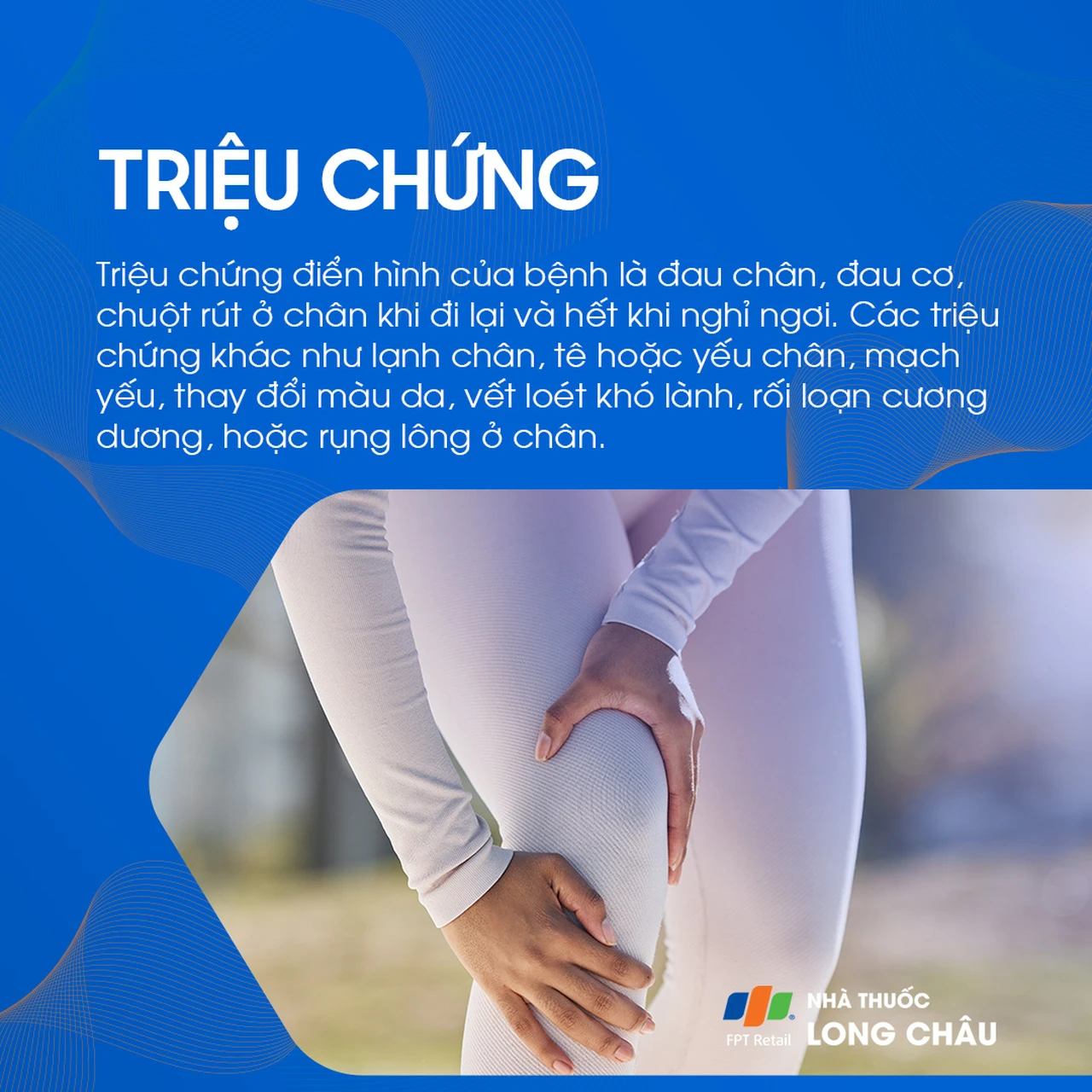Hẹp động mạch chi dưới 2