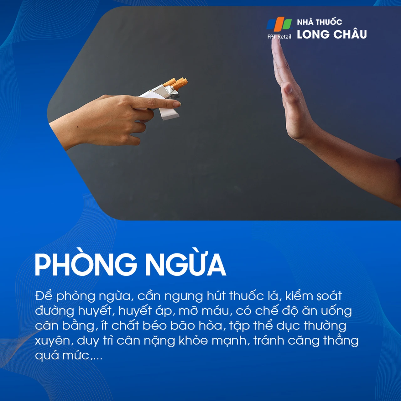 Hẹp động mạch chi dưới 7